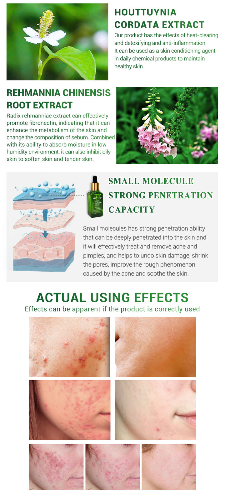 Camellia Sinensis Leaf Extract Anti-Acne Serum