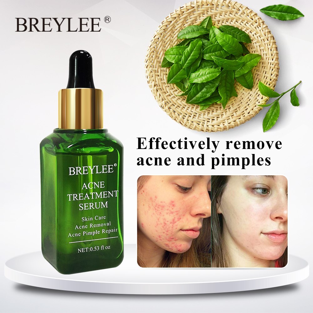 Camellia Sinensis Leaf Extract Anti-Acne Serum